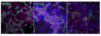 Confocal images of the abundant cells (left and middle) and the H7N9 virus infected (right) cells in the 2D mature airway organoids. Nuclei and cellular actin filaments were counter-stained in blue and purple.