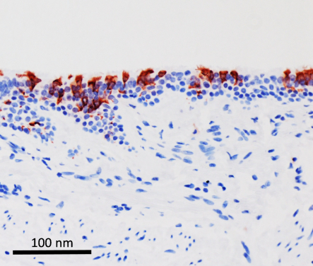 受Omicron病毒感染(呈紅色)後的人類支氣管組織

 
