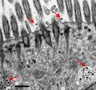 電子顯微鏡下人類支氣管組織感染新型冠狀病毒(紅色箭嘴顯示病毒顆粒)

 