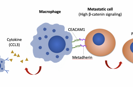 HKU Biologists Reveal a Novel Macrophages-mediated Mechanism that Promotes Peritoneal Metastasis of Ovarian Cancer,  Providing Important Insights into Its Therapeutic Strategy