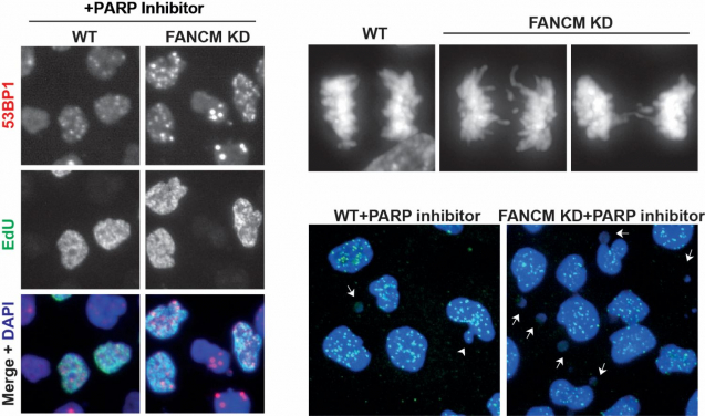 Image 1. Inactivation of a DNA repair gene called FANCM enhances the formation of DNA damage and chromosomal instability induced by a PARP inhibitor, leading to massive cancer cell death.
Image modified from Liu et al, Cell Reports (2024).
 