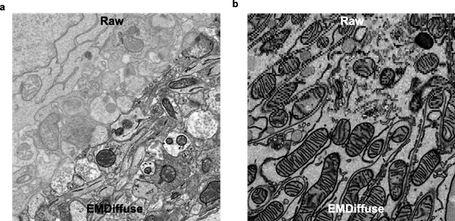 (a) EMDiffuse removes noise and restores ultrastructure information from noisy electron microscope images; (b) EMDiffuse enhances the axial resolution of volume electron microscope data. Image modified from Lu et al, Nature Communications (2024).